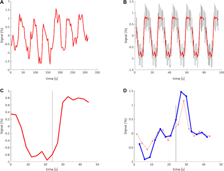 Improved localization of language areas using single voxel signal analysis of unprocessed fMRI data.