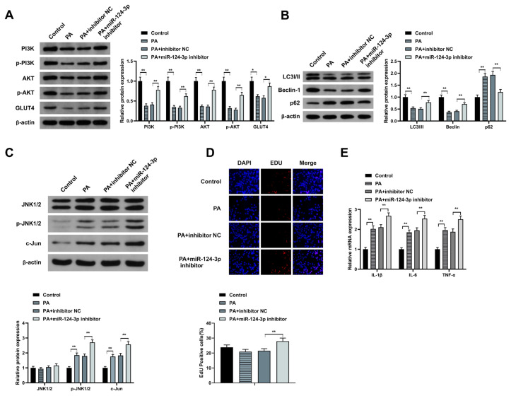 Palmitic acid declines glucose uptake in HepG2 cells via modulating phosphoglucomutase 1 to repress phosphatidylinositol 3 kinase/protein kinase B and JNK pathways via inducing microRNA-124-3p.