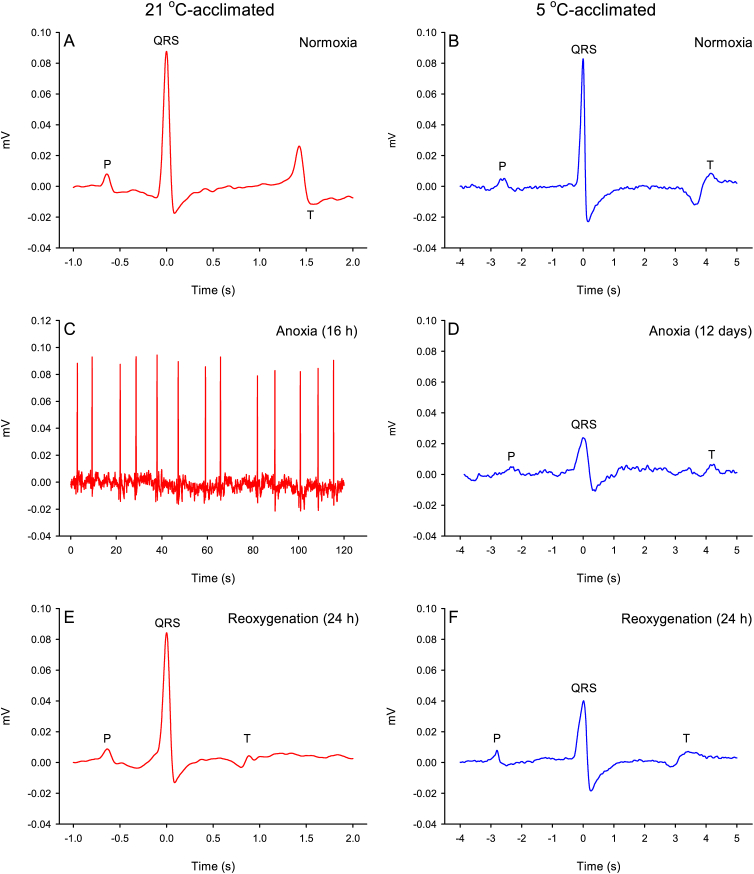 Does the ventricle limit cardiac contraction rate in the anoxic turtle (Trachemys scripta)? II. In vivo and in vitro assessment of the prevalence of cardiac arrhythmia and atrioventricular block