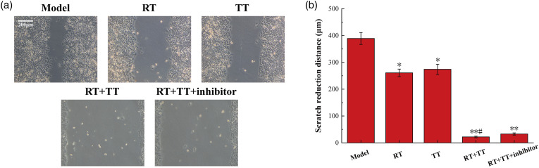 The mechanism of radiotherapy for lung adenocarcinoma in promoting protein SIRT6-mediated deacetylation of RBBP8 to enhance the sensitivity of targeted therapy.