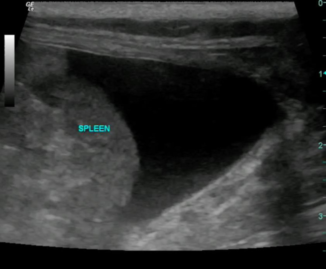 A mediastinal mass causing Budd-Chiari-like syndrome in a cat.