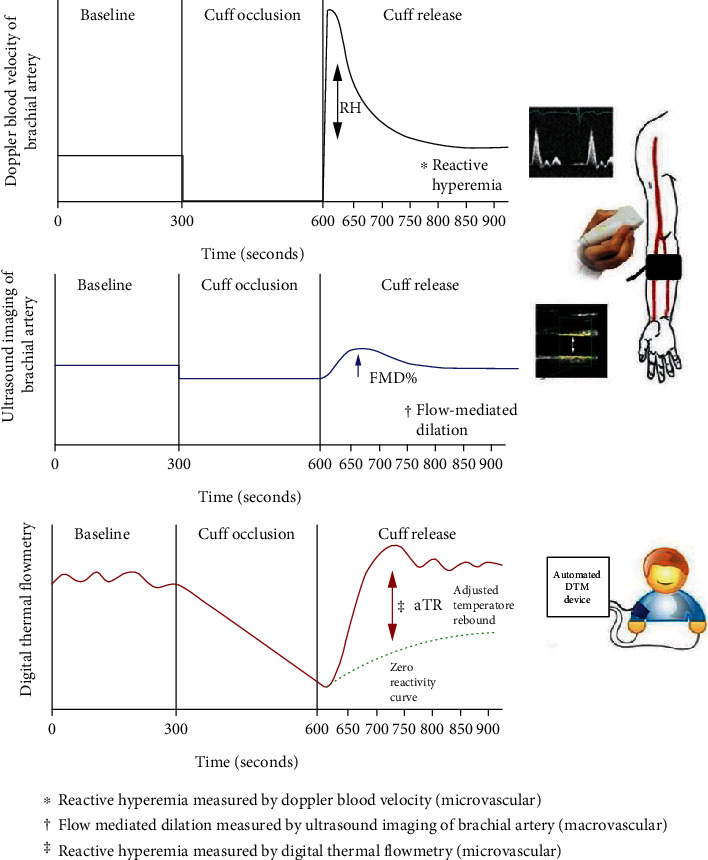 High Frequency of Microvascular Dysfunction in US Outpatient Clinics: A Sign of High Residual Risk? Data from 7,105 Patients.