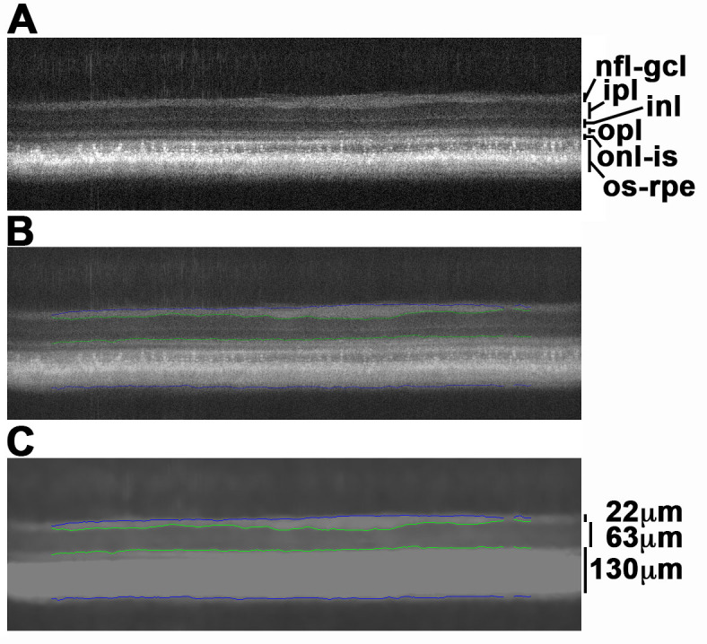 Novel segmentation algorithm for high-throughput analysis of spectral domain-optical coherence tomography imaging of teleost retinas.