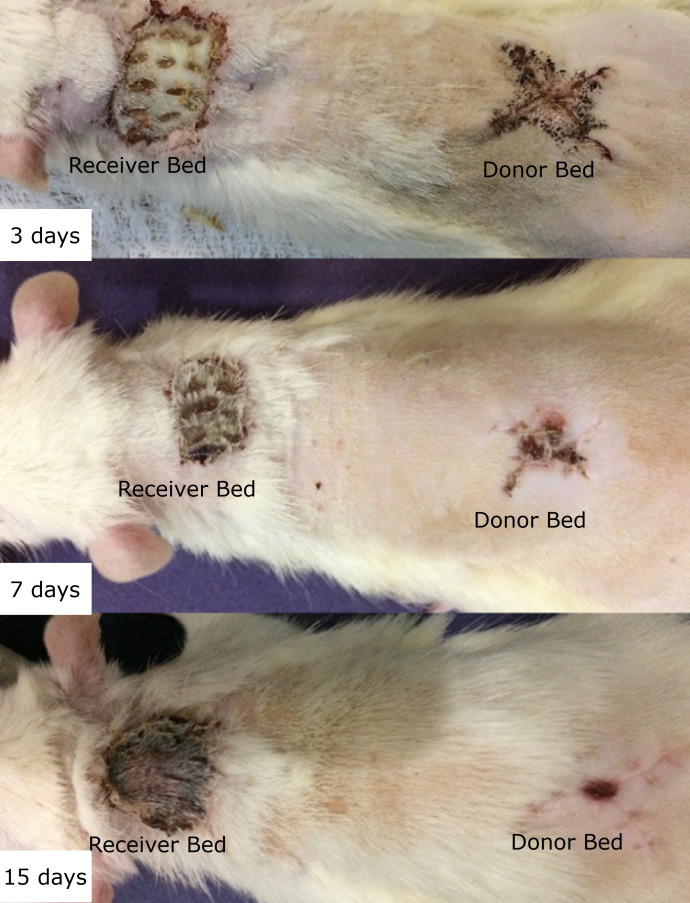 Skin graft associated with platelet-rich plasma in correcting extensive injuries resulting from the resection of skin cancer chemically induced in rats.