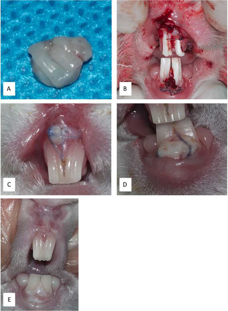 Effect of leukocyte and platelet-rich fibrin on free gingival graft healing: A clinical and histological study in rabbits.