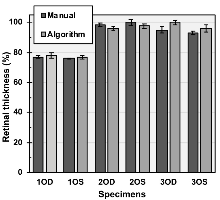 Novel segmentation algorithm for high-throughput analysis of spectral domain-optical coherence tomography imaging of teleost retinas.