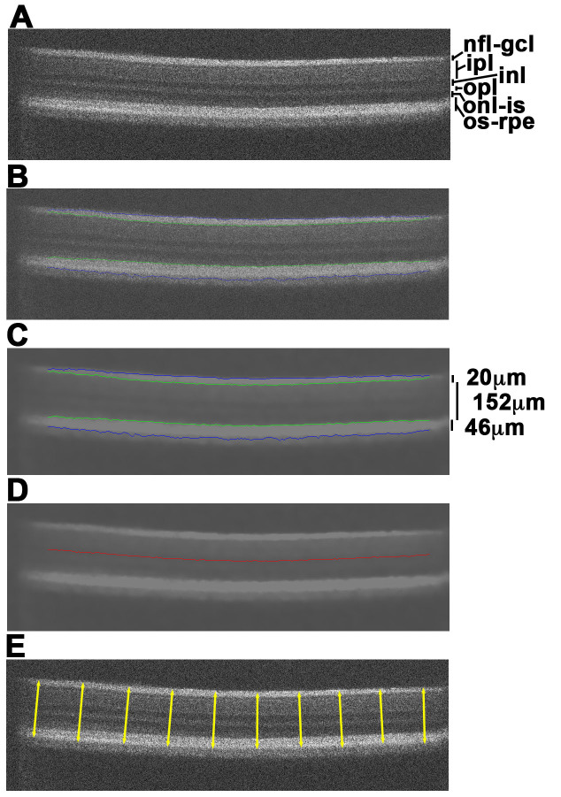 Novel segmentation algorithm for high-throughput analysis of spectral domain-optical coherence tomography imaging of teleost retinas.