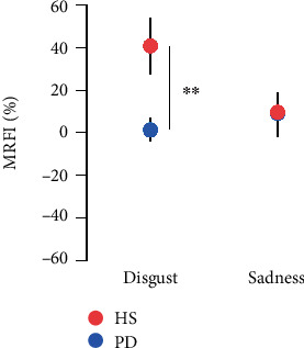 Motor Resonance Flexibility to Emotion-Enriched Context in Parkinson's Disease Patients.