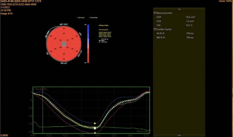 Dyspnea in pregnancy might be related to the incomplete physiological adaptation of the heart.