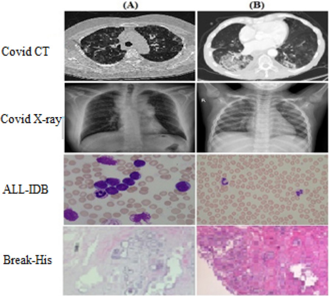 An enforced block diagonal low-rank representation method for the classification of medical image patterns.