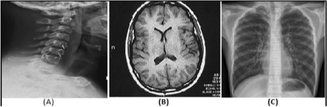 An enforced block diagonal low-rank representation method for the classification of medical image patterns.