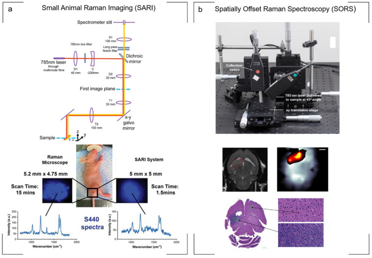 Advances in Surface Enhanced Raman Spectroscopy for <i>in Vivo</i> Imaging in Oncology.