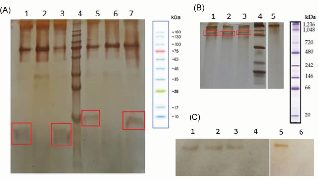 Expression of functional eGFP-fused antigen-binding fragment of ranibizumab in <i>Pichia pastoris</i>.