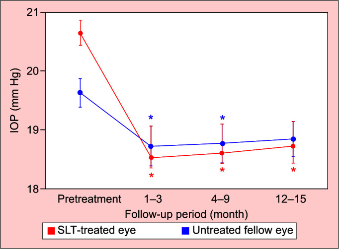 Consensual Ophthalmotonic Reaction Following Selective Laser Trabeculoplasty.