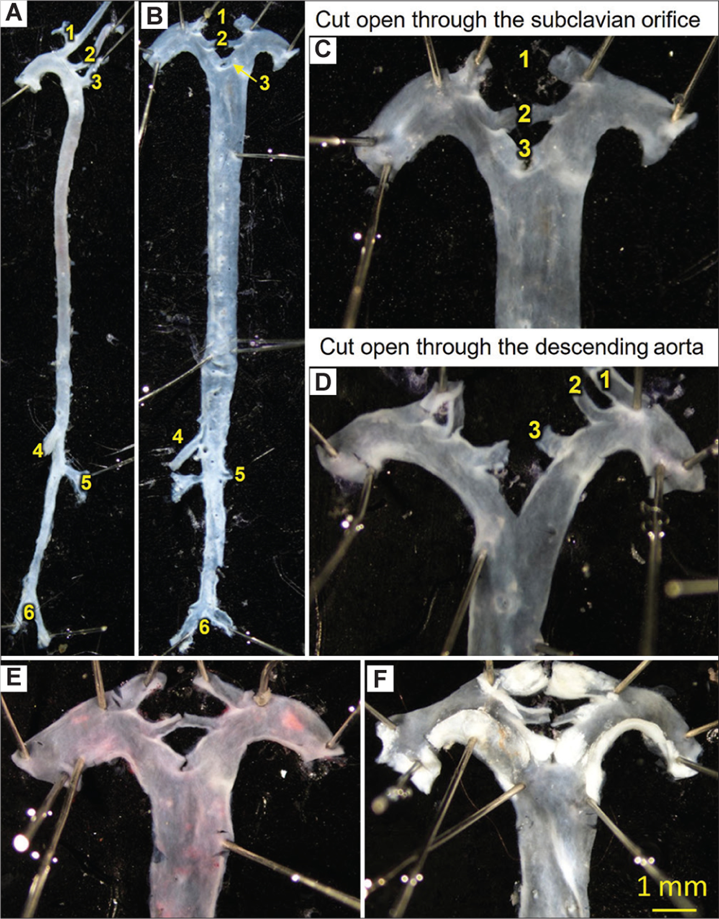 A mini-review on quantification of atherosclerosis in hypercholesterolemic mice.