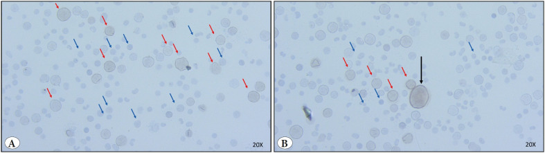 Analysis of DUX4 Expression in Bone Marrow and Re-Discussion of DUX4 Function in the Health and Disease.