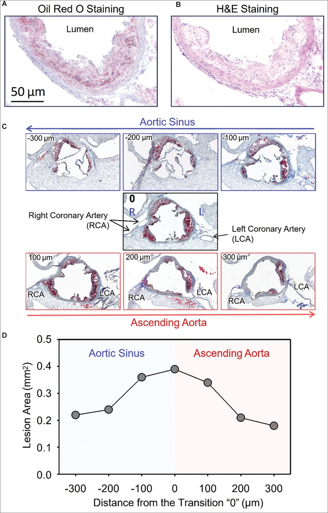 A mini-review on quantification of atherosclerosis in hypercholesterolemic mice.