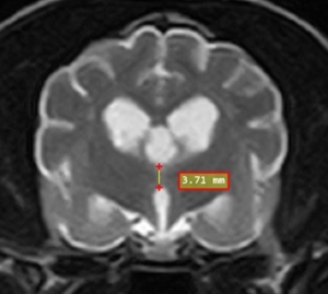 MRI abnormalities in a severe cognitive impairment mimicking a forebrain lesion in a geriatric dog.