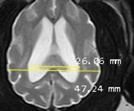 MRI abnormalities in a severe cognitive impairment mimicking a forebrain lesion in a geriatric dog.