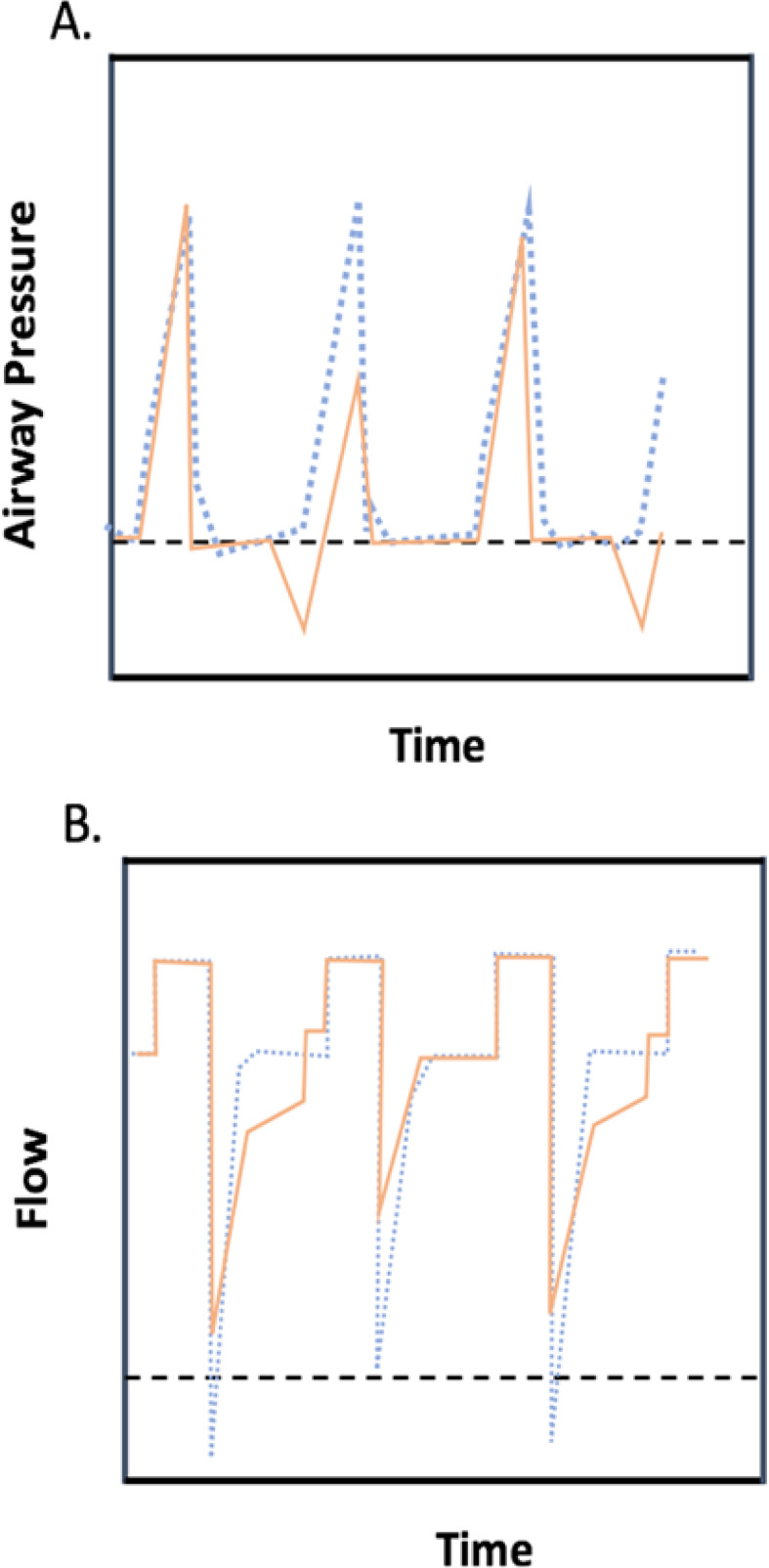 A deep look into the rib cage compression technique in mechanically ventilated patients: a narrative review.