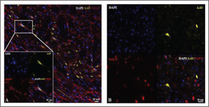 The Effects of Optogenetic Activation of Astrocytes on Spike-and-Wave Discharges in Genetic Absence Epileptic Rats.