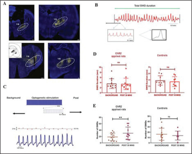 The Effects of Optogenetic Activation of Astrocytes on Spike-and-Wave Discharges in Genetic Absence Epileptic Rats.