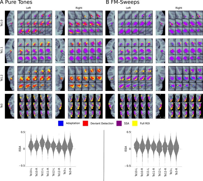 Predictive encoding of pure tones and FM-sweeps in the human auditory cortex.