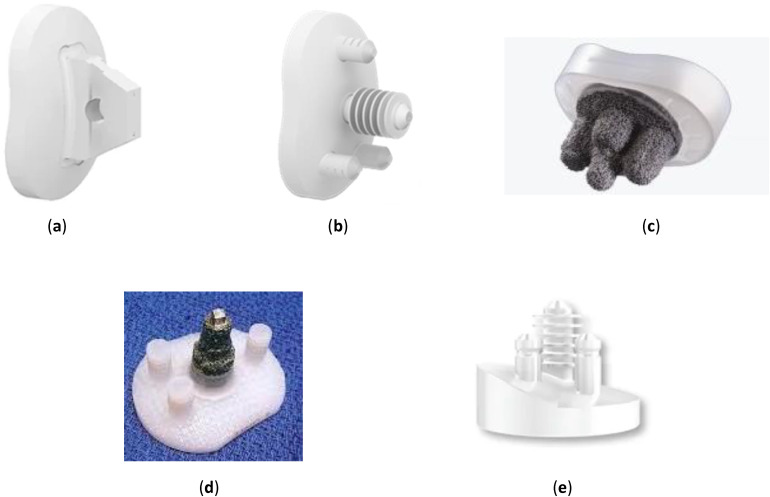 Glenoid Prosthesis Design Considerations in Anatomic Total Shoulder Arthroplasty.