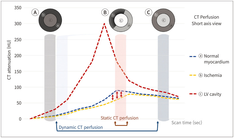 [Beyond Coronary CT Angiography: CT Fractional Flow Reserve and Perfusion].