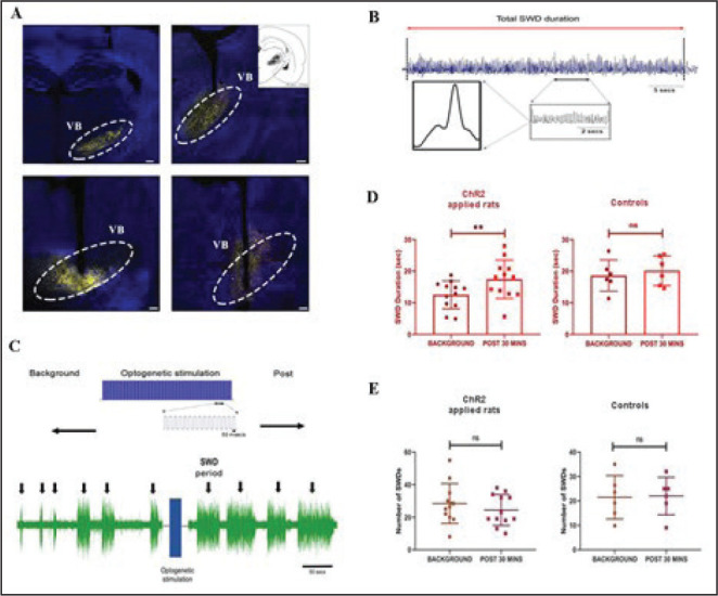 The Effects of Optogenetic Activation of Astrocytes on Spike-and-Wave Discharges in Genetic Absence Epileptic Rats.