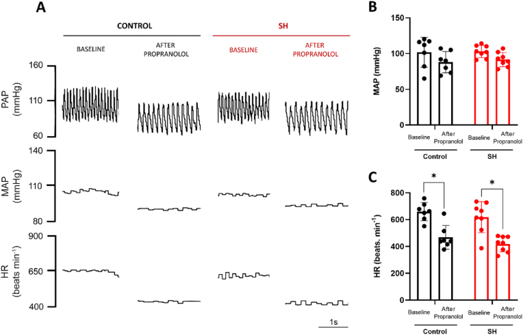 Sustained hypoxia in mice increases parasympathetic but not sympathetic tone