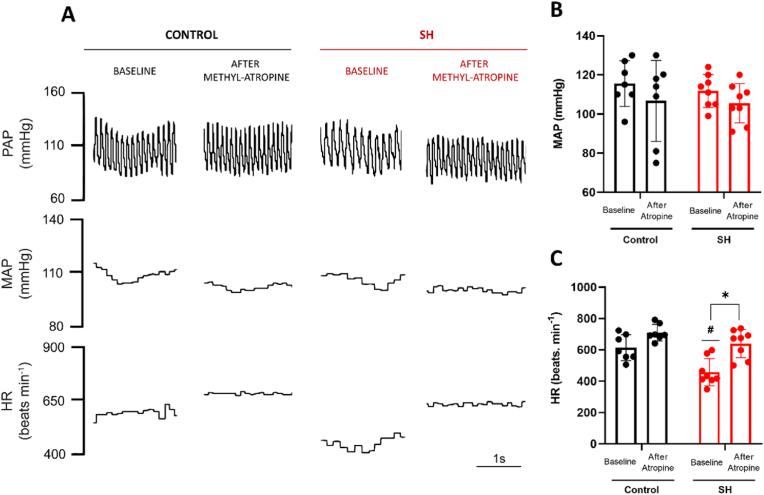 Sustained hypoxia in mice increases parasympathetic but not sympathetic tone