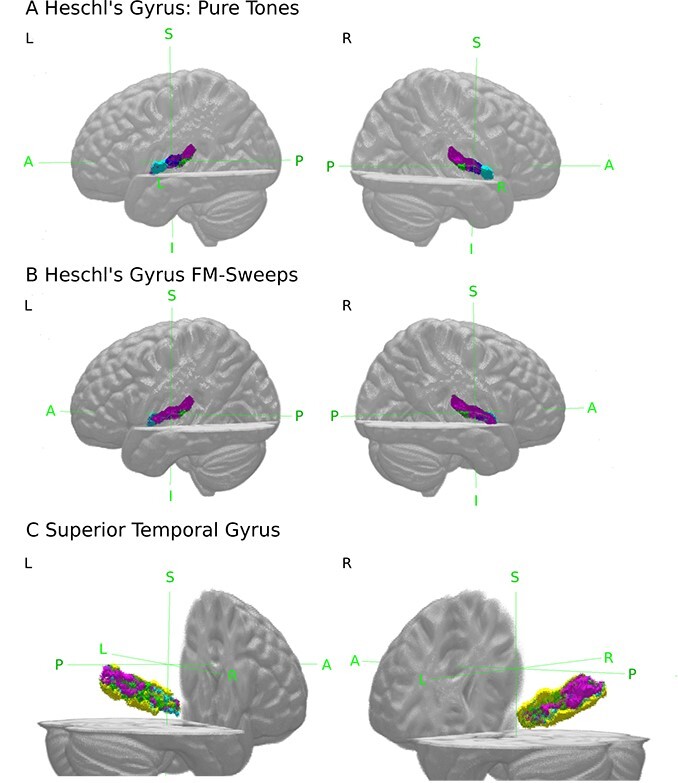 Predictive encoding of pure tones and FM-sweeps in the human auditory cortex.