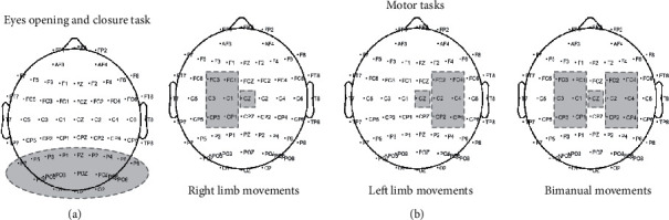 The Neurophysiological Impact of Subacute Stroke: Changes in Cortical Oscillations Evoked by Bimanual Finger Movement.