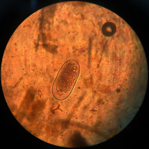 Seasonal Prevalence of Helminthic Infections in the Gastrointestinal Tract of Sheep in Mazandaran Province, Northern Iran.