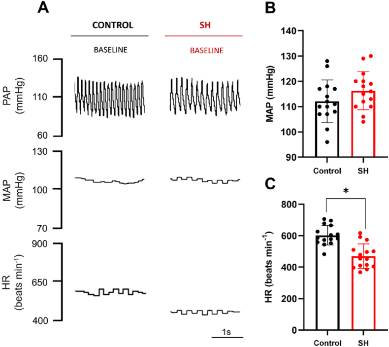 Sustained hypoxia in mice increases parasympathetic but not sympathetic tone