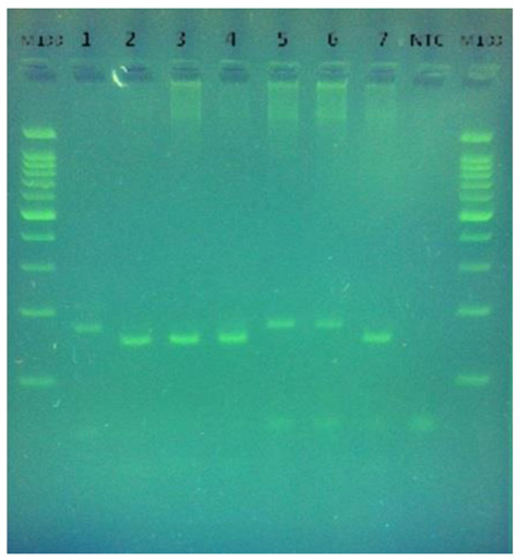 DNA sequencing validation by PCR-RFLP for evaluating butyrophilin-like 2 rs2076530 polymorphism in Iranian patients with sarcoidosis.