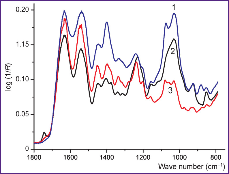 Express Analysis of Cartilage Tissue Using Multivariate Analysis of IR Spectra.