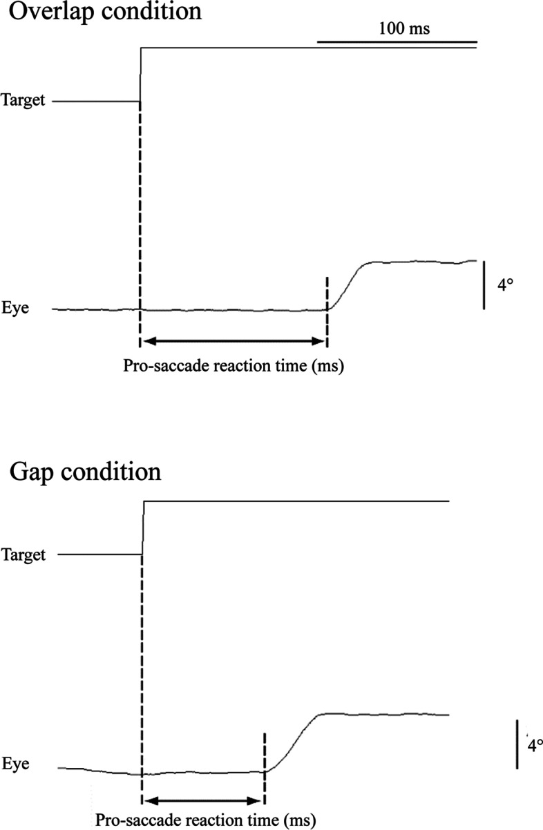 Influence of sports experience on distribution of pro-saccade reaction time under gap condition.