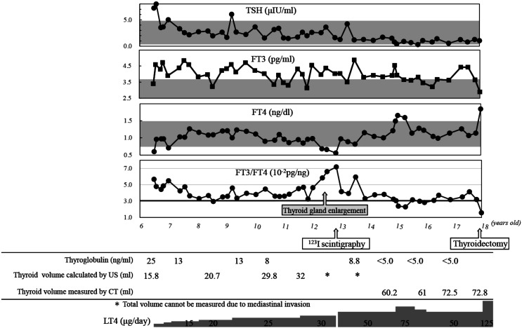 Goiter in a 6-year-old patient with novel thyroglobulin gene variant (Gly145Glu) causing intracellular thyroglobulin transport disorder: Correlation between goiter size and the free T3 to free T4 ratio.