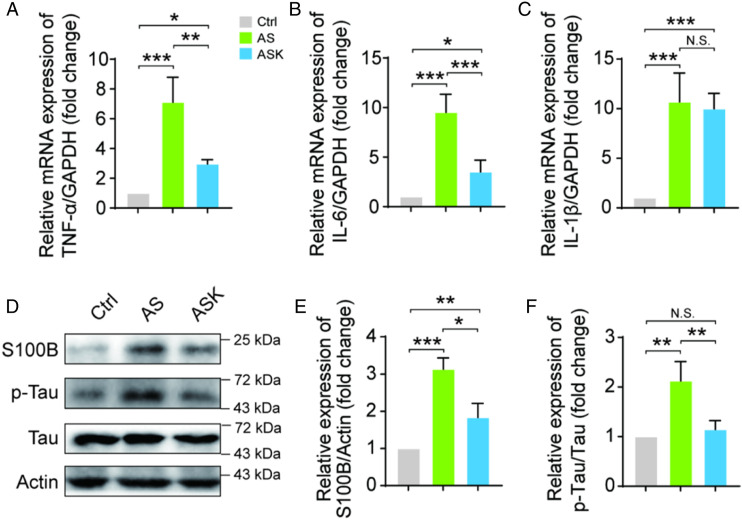 Prophylactic Effects of Sub-anesthesia Ketamine on Cognitive Decline, Neuroinflammation, and Oxidative Stress in Elderly Mice.
