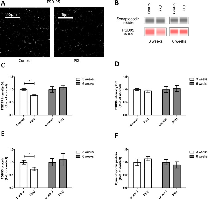 A culture model for the assessment of phenylalanine neurotoxicity in phenylketonuria.