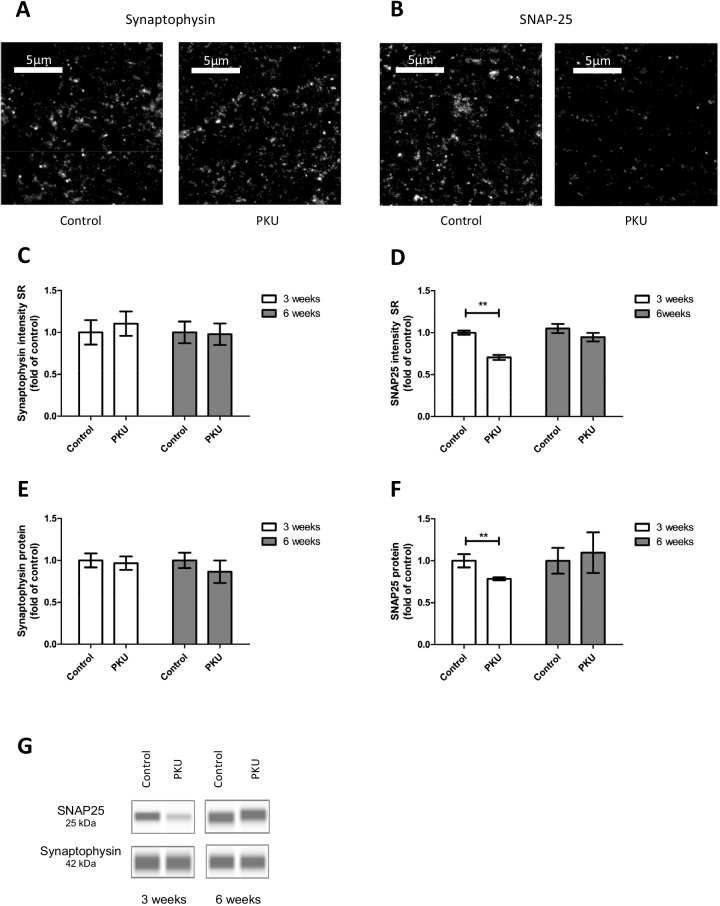 A culture model for the assessment of phenylalanine neurotoxicity in phenylketonuria.