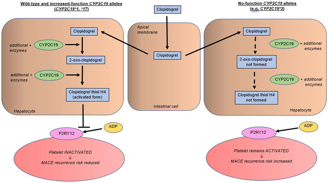Ticagrelor is more effective than clopidogrel in carrier of nonfunctional <i>CYP2C19</i> allele who has diabetes and acute coronary syndrome - case report and literature review.