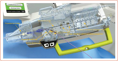 Robotic Percutaneous Coronary Intervention: The Good, the Bad, and What is to Come.