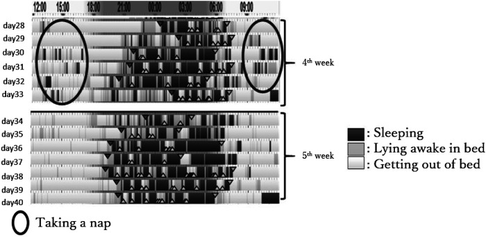 Using a Non-Wearable Actigraphy in Nursing Care for Dementia With Lewy Bodies.