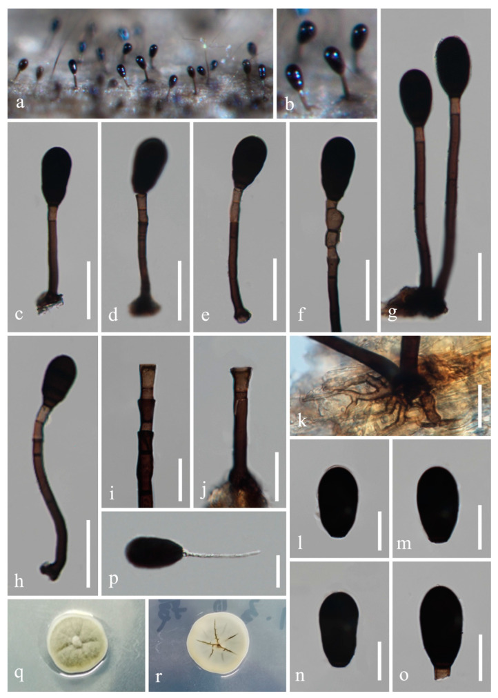 Morpho-Phylogenetic Evidence Reveals New Species of Fuscosporellaceae and Savoryellaceae from Freshwater Habitats in Guizhou Province, China.