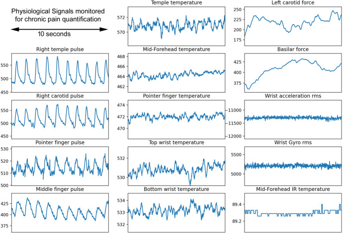 Preliminary study: quantification of chronic pain from physiological data.