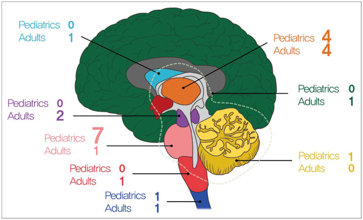 Clinical Features and Prognosis of Diffuse Midline Glioma: A Series of 24 Cases.