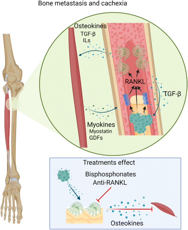 Muscle and Bone Defects in Metastatic Disease.